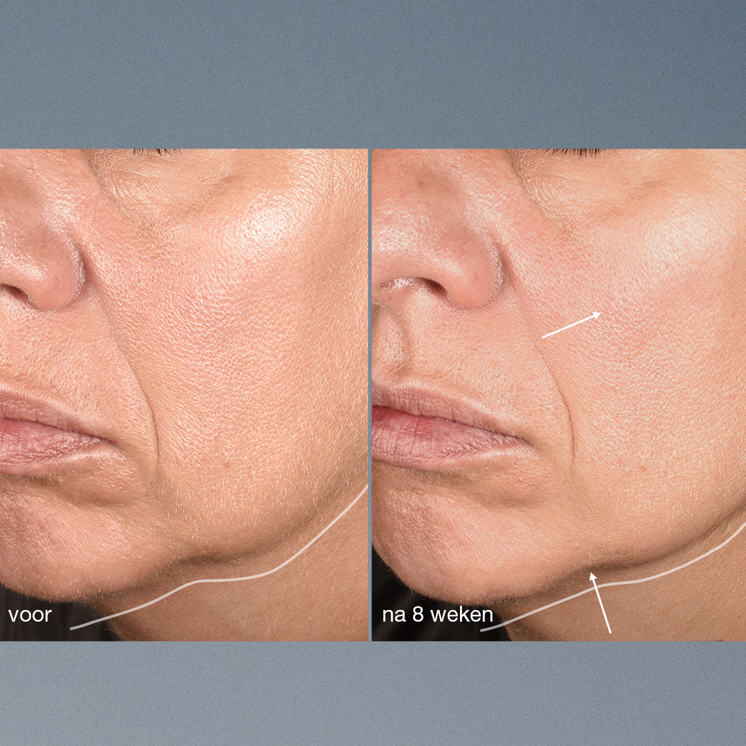 NeuroTouchSymmetrySerum-B_A