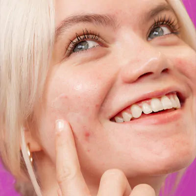 Post Breakout Fix skin quiz 1