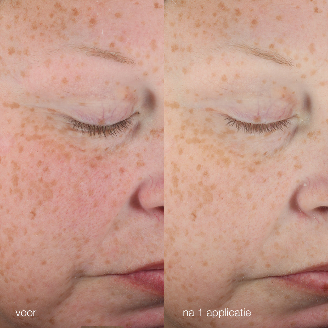 Biolumin-C Heat Aging Protector SPF50 - voor en na