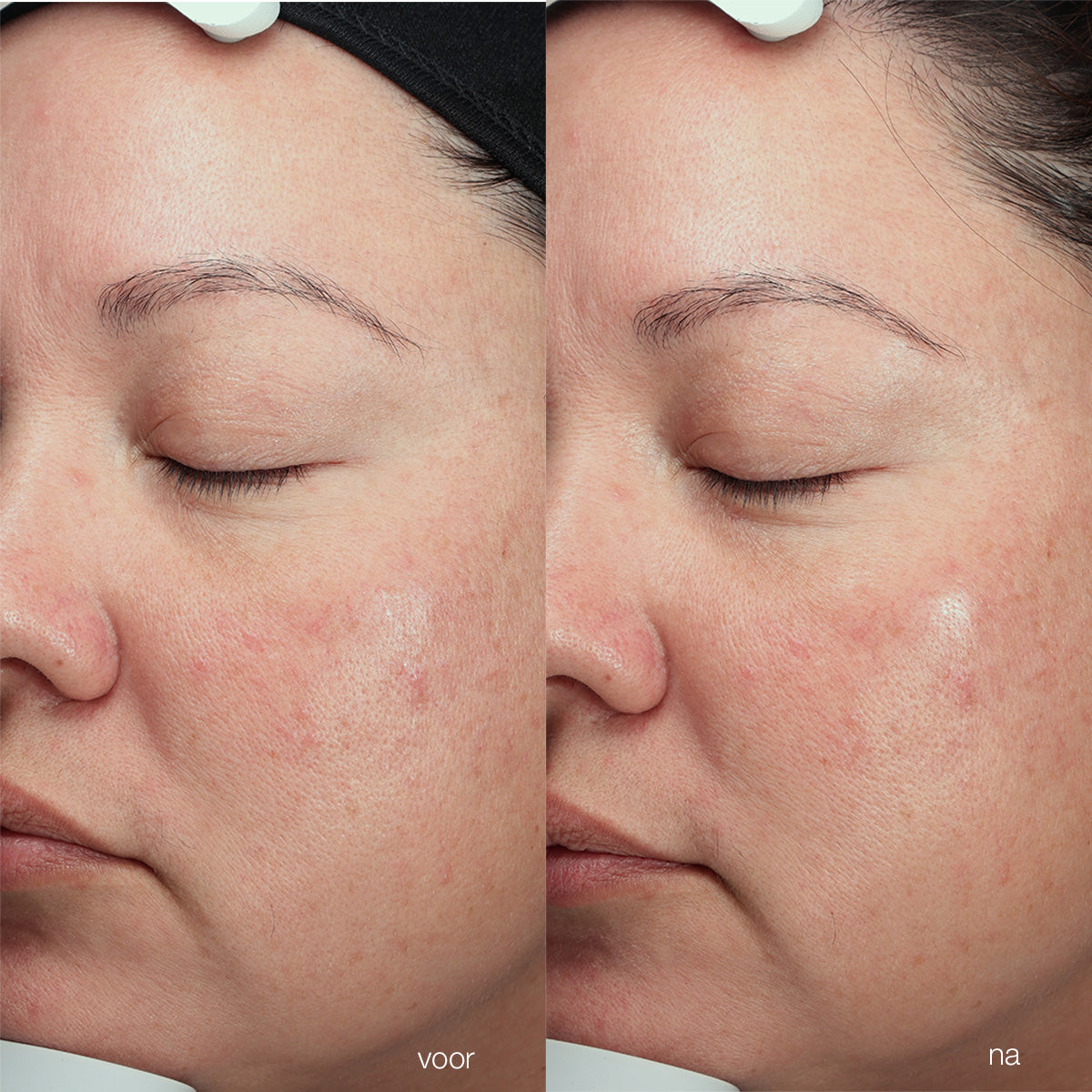 Dermalogica Magnetic Afterglow Cleanser before & after