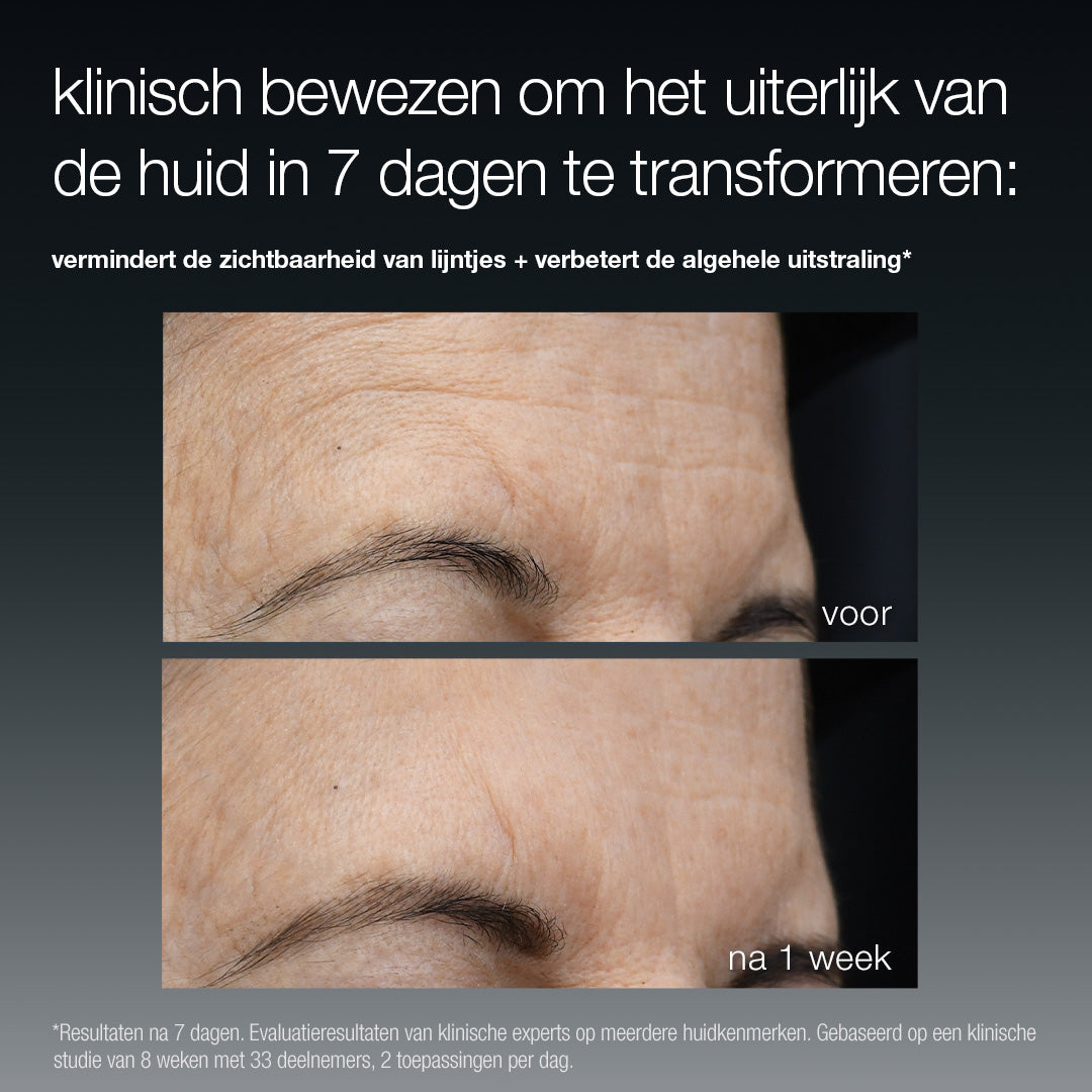before & after