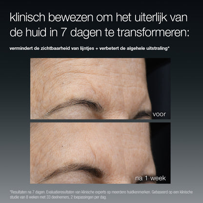 before & after