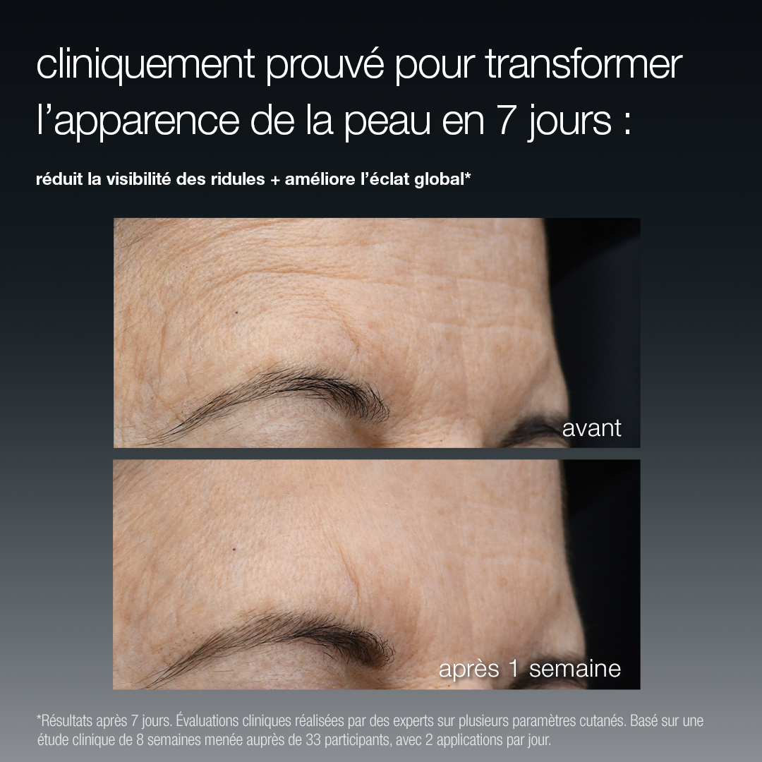 Dermalociga FutureCode Booster Before & after Franstalig