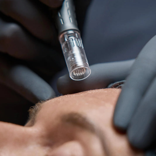 PRO-TREATMENTS-PAGE_PRO-MICRONEEDLING