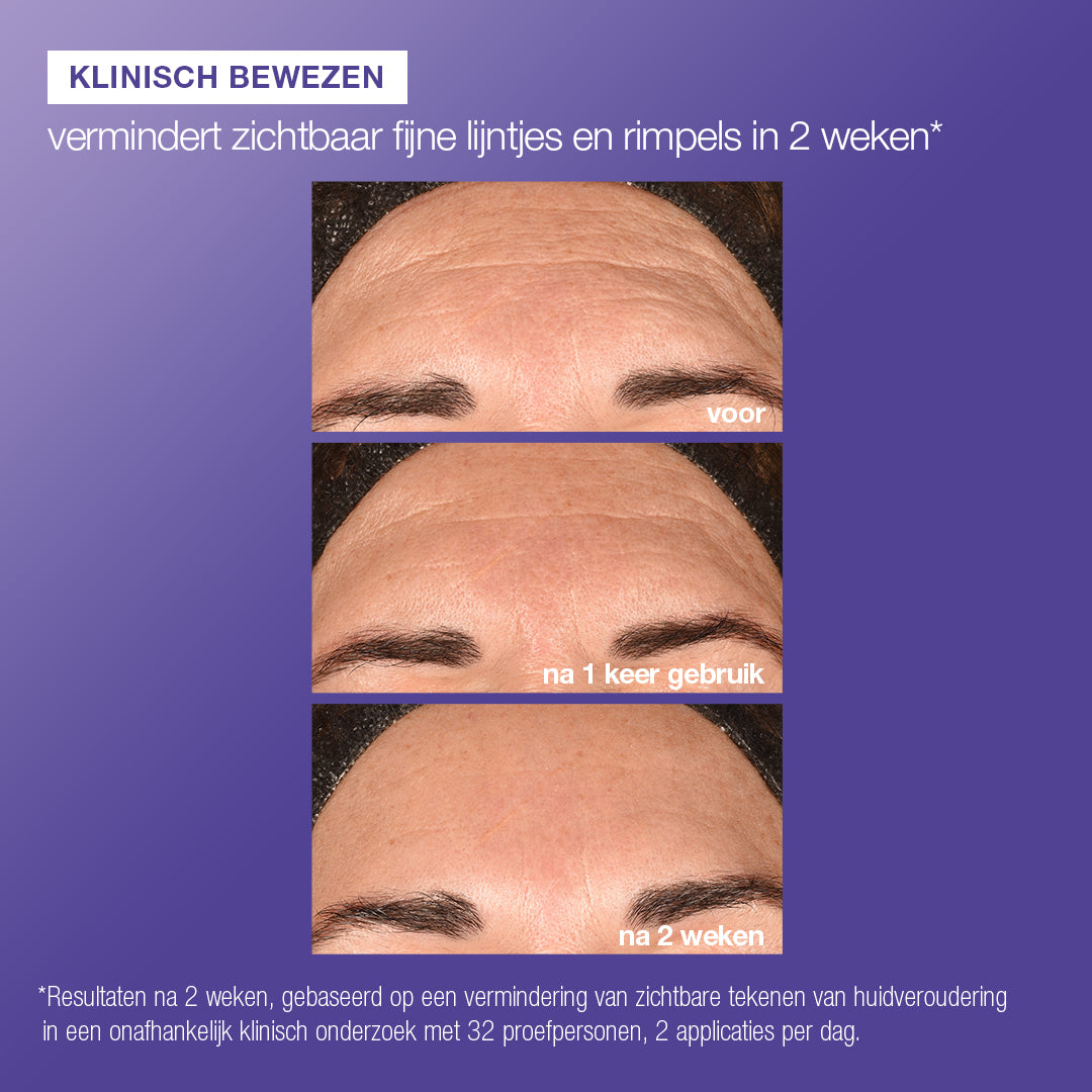 Phyto nature e2 voor en na