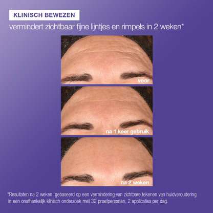 Phyto nature e2 voor en na