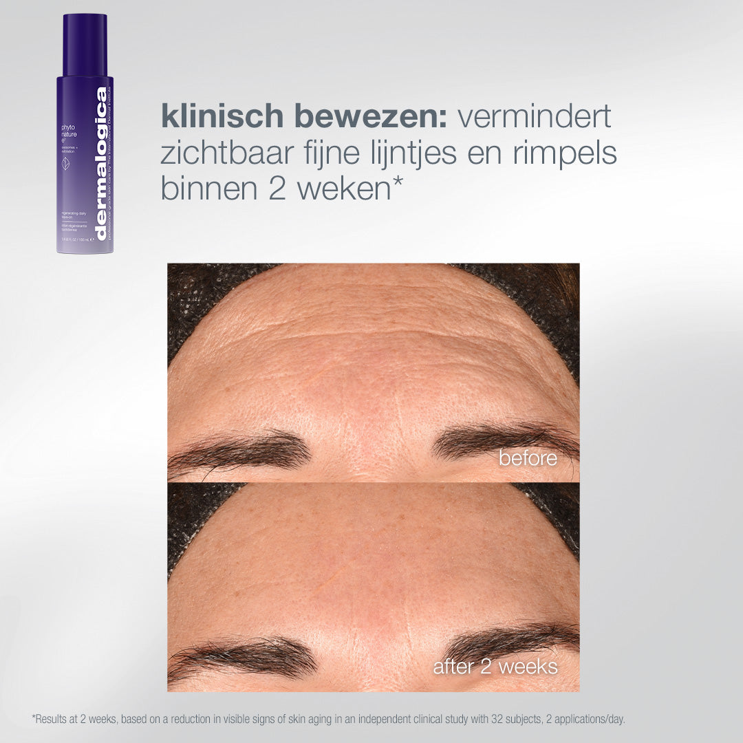 Phyto Nature E²: voor en na