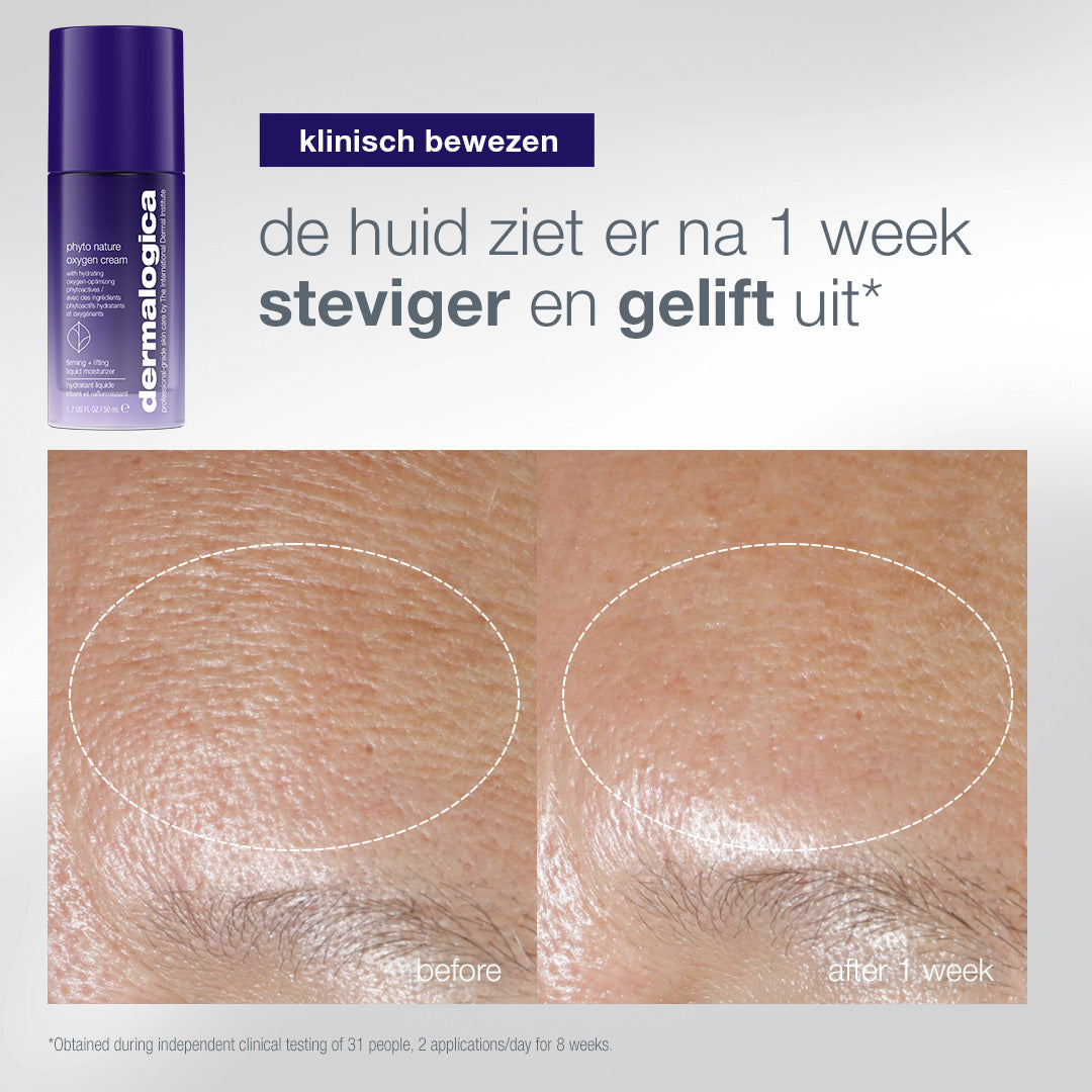 Phyto Nature Oxygen Cream: voor en na