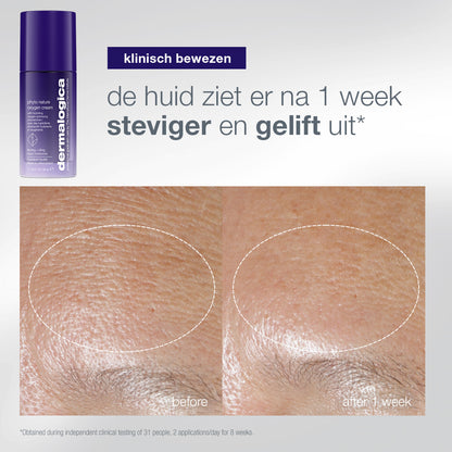 Phyto Nature Oxygen Cream: voor en na