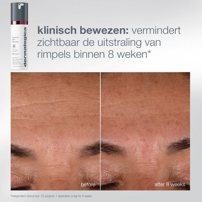 Dynamic Skin Retinol Serum: voor en na