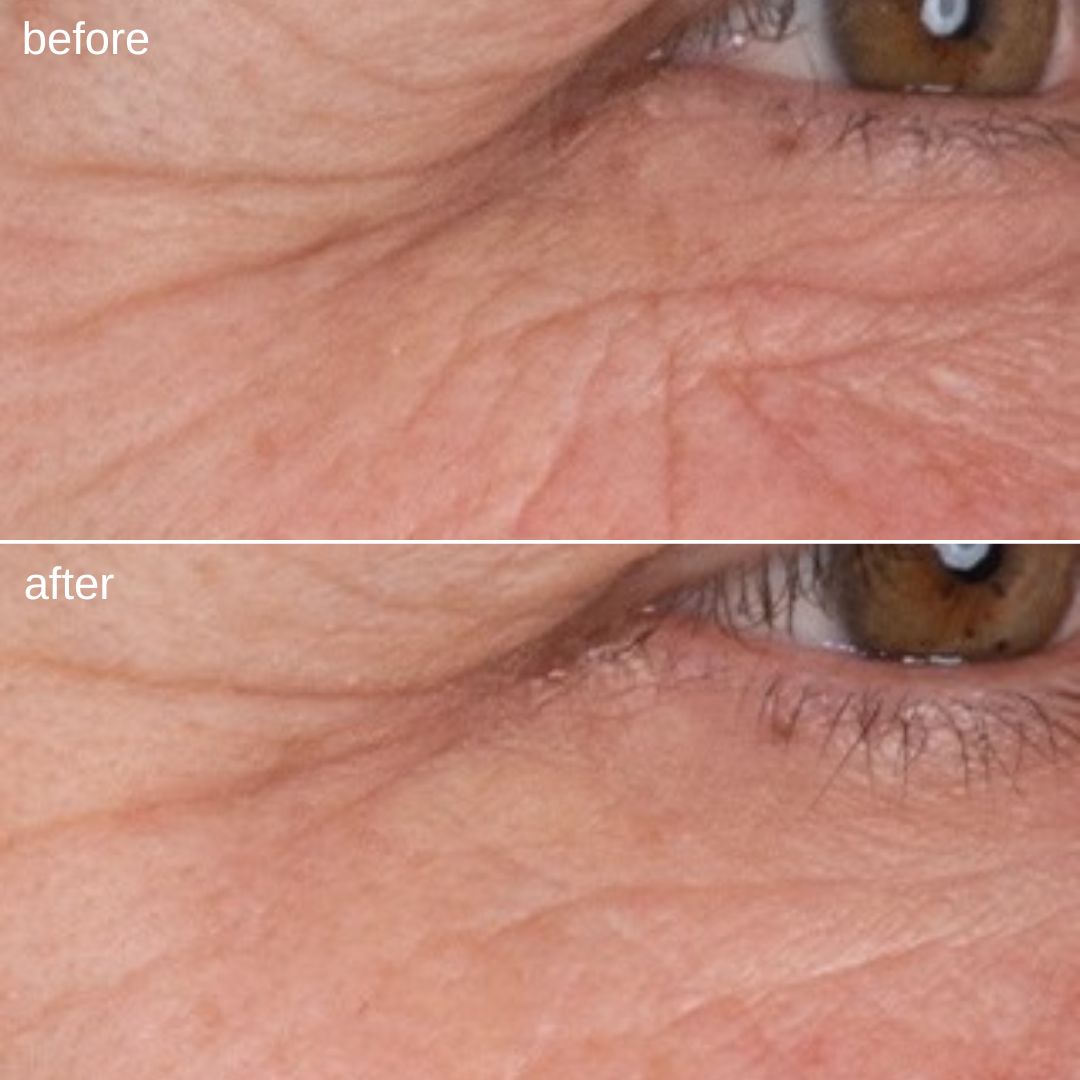 dynamic skin retinol serum - before & after